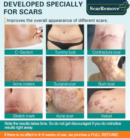 Grunsify Advanced Scar Repair Cream – Fade Scars & Tighten Skin for Men and Women