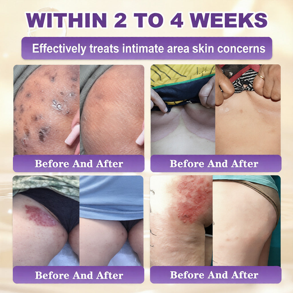 Made and Shipped from USA Virexo™ Biotin 10-in-1 Skin Restoration Cream