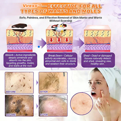 Made and Shipped from USA Virexo™ Biotin 10-in-1 Skin Restoration Cream
