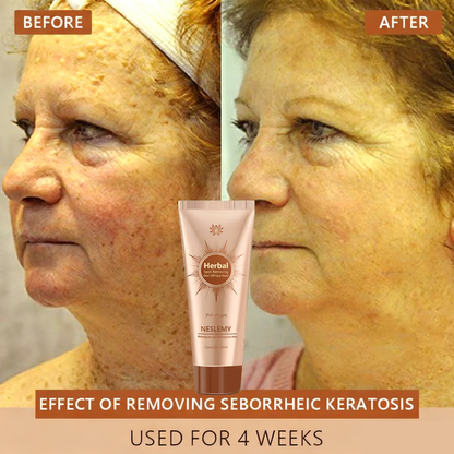 Whitening & Spot-Removing Mask – 👩‍⚕️ Natural Ingredients for Age Spots, Freckles, and Sun Spots