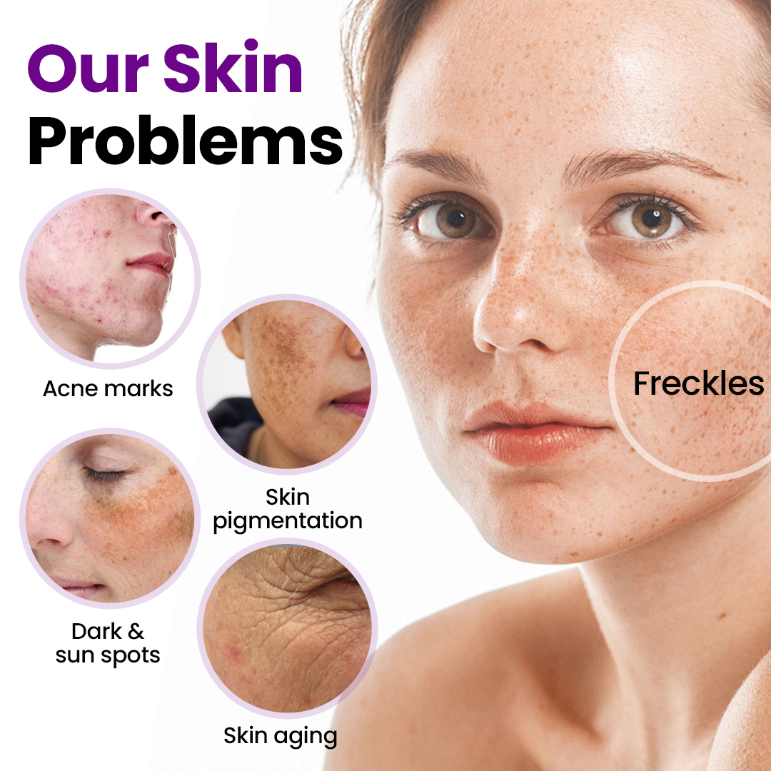 LOVILDS® SpotErase Probiotic Shield Serum