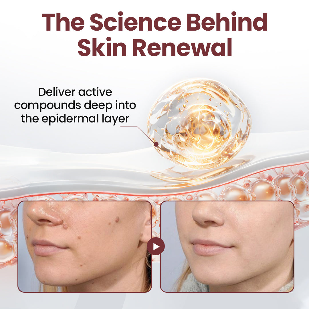 TAILEDEN KeraErase Dual-Action Renewal Cream