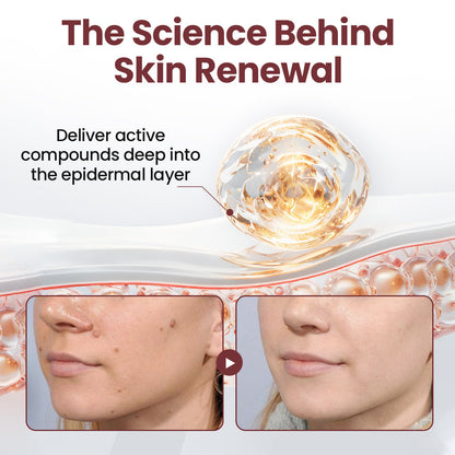 TAILEDEN KeraErase Dual-Action Renewal Cream