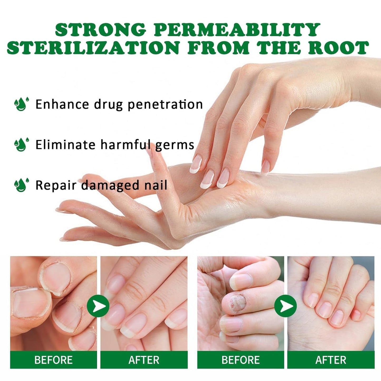 LOVILDS Natural Nail Fungus Treatment Gel - Fungus Cream, Multi-Purpose Nail Repair