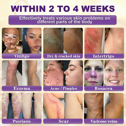 Made and Shipped from USA Virexo™ Biotin 10-in-1 Skin Restoration Cream
