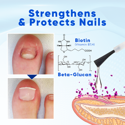 LOVILDS® OnyxoGuard Nail Growth and Repair Serum