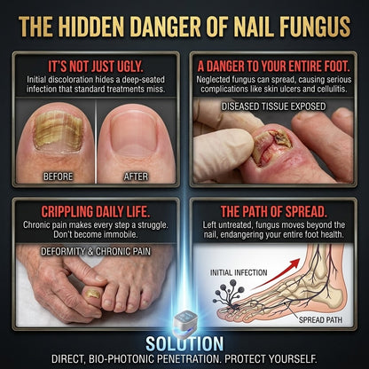 TIWORLD™ - Nail Fungus Laser Device -More scientific nail care