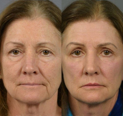 LOVILDS Revitalizing Eye Essence: Reduces Dark Circles, Eliminates Fatigue, and Brightens Tired Eyes.