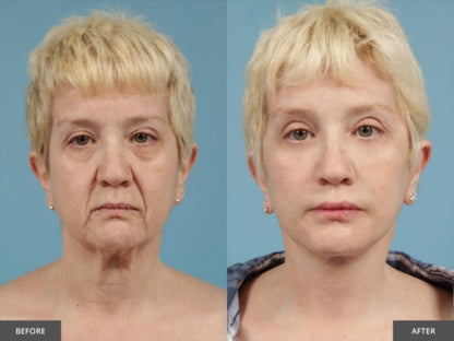 LOVILDS Eye Serum. Eliminate fatigue and revitalize your eyes!